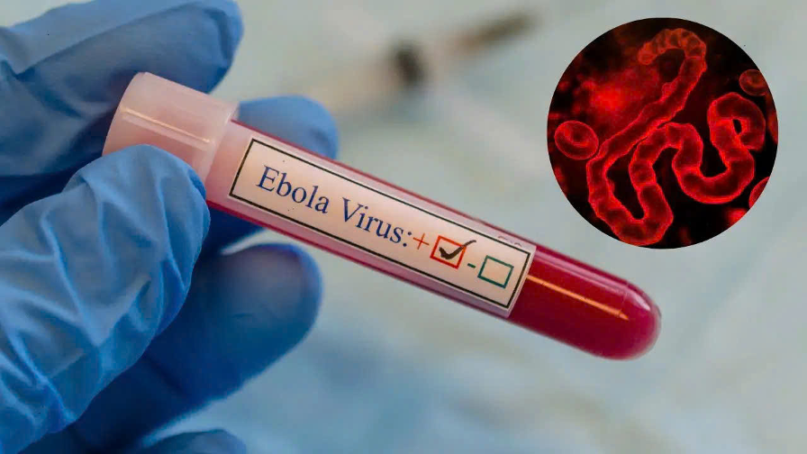 Vi rút Ebola cướp đi hơn 130 sinh mạng, Bộ Y tế lên kịch bản ứng phó khẩn