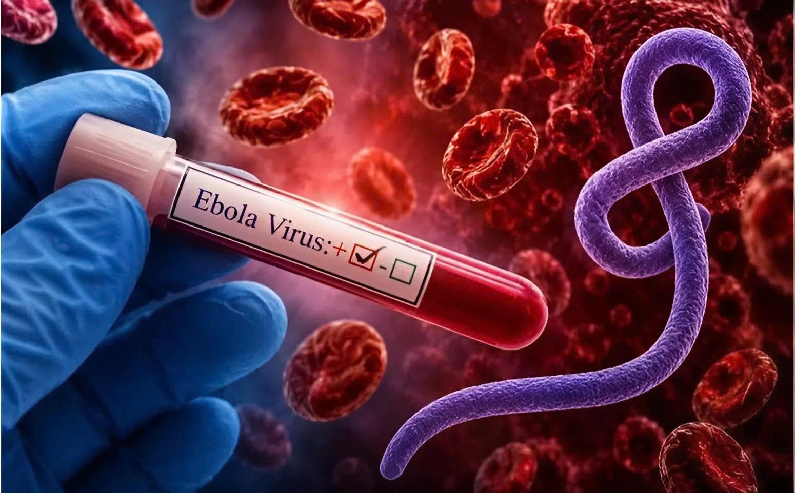 Bộ Y tế ban hành hướng dẫn mới về chẩn đoán và điều trị bệnh do vi rút Ebola