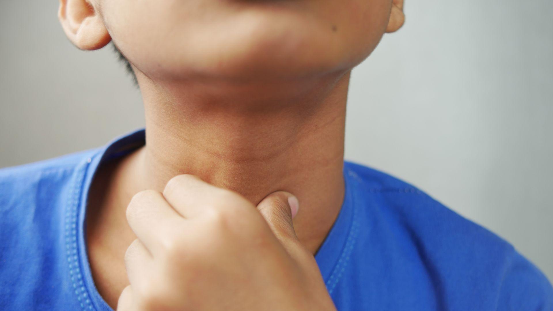 Cảnh báo viêm thanh quản cấp ở trẻ nhỏ: Sai lầm mùa hè cha mẹ cần tránh