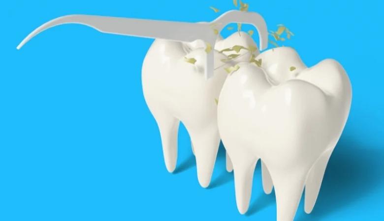 Tầm quan trọng của chỉ nha khoa và cách sử dụng chuẩn y khoa Tầm quan trọng của chỉ nha khoa và cách sử dụng chuẩn y khoa