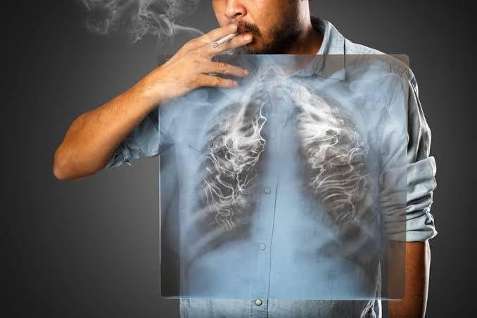 Hoàn thiện hàng rào pháp lý về phòng chống tác hại thuốc lá từ sớm và từ xa