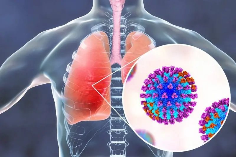 Những hiểu lầm khiến trẻ dưới 1 tuổi bỏ lỡ "thời điểm vàng" phòng virus RSV