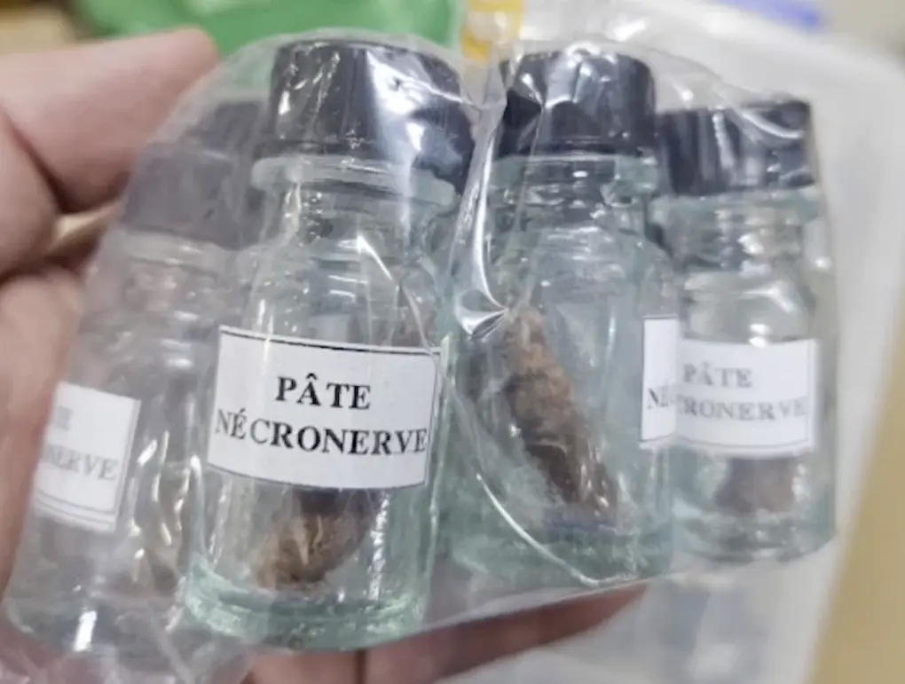 Cảnh báo nguy cơ hoại tử xương hàm do dùng thạch tín diệt tủy răng Cảnh báo nguy cơ hoại tử xương hàm do dùng thạch tín diệt tủy răng