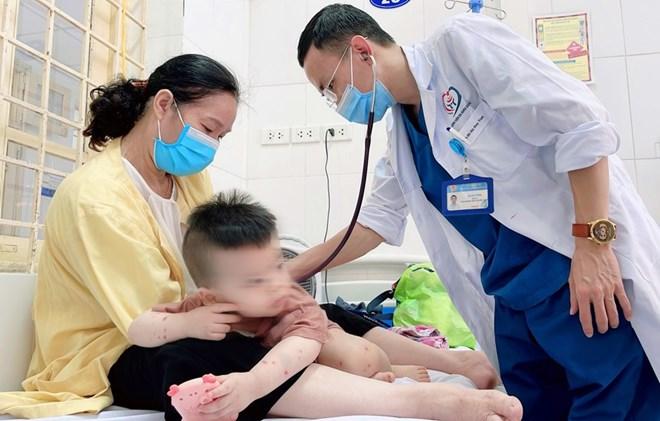 Gần 100.000 ca mắc tay chân miệng, Bộ Y tế khuyến cáo khẩn các biện pháp phòng lây nhiễm Gần 100.000 ca mắc tay chân miệng, Bộ Y tế khuyến cáo khẩn các biện pháp phòng lây nhiễm