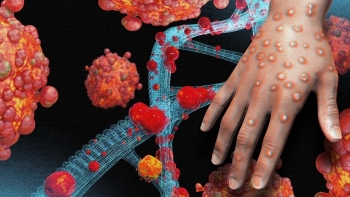 Chủ động kiểm soát, phòng, chống dịch bệnh đậu mùa khỉ