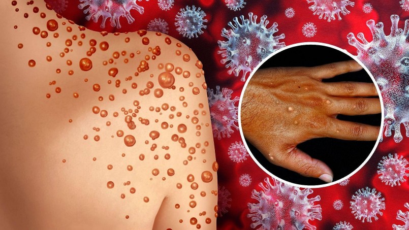 nguy cơ dịch bệnh xâm nhập vào Việt Nam là hoàn toàn có thể