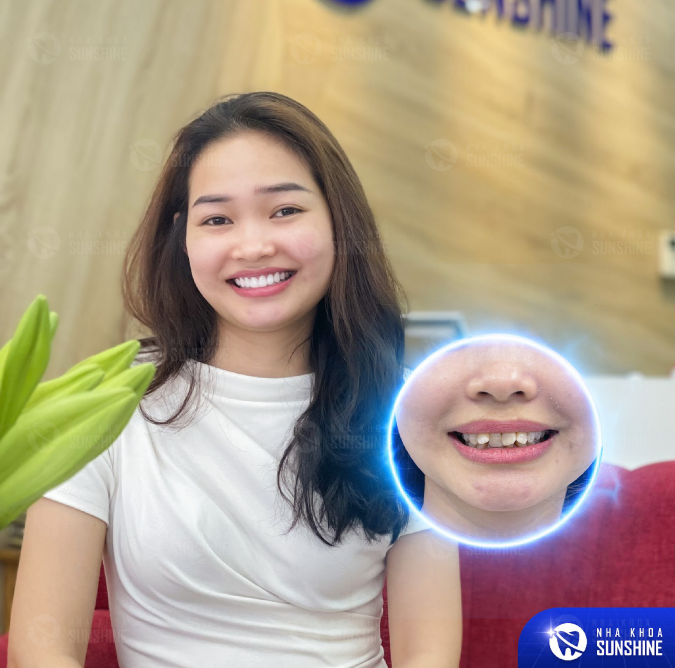 Chỉ với 1 phương pháp làm đẹp đơn giản, bạn đã có thể thấy rõ sự khác biệt trên khuôn mặt.