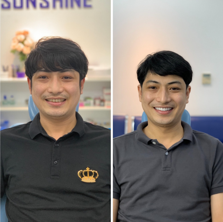 Thiết kế nụ cười phong độ cho nam giới với công nghệ thẩm mỹ hiện đại nhất.