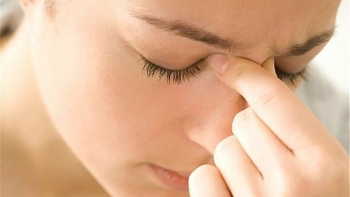 Thời tiết thay đổi, bỏ túi TPBVSK hỗ trợ cải thiện và ngăn ngừa viêm xoang