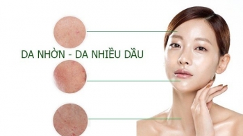 Tips các sản phẩm skincare dành cho cô nàng da dầu mụn