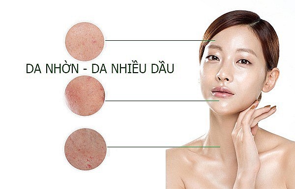Tips chọn các sản phẩm skincare dành cho cô nàng da dầu mụn