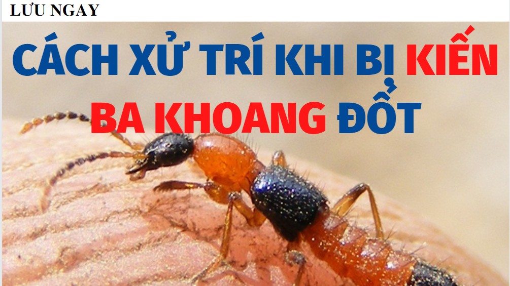 Lưu ngay một số cách xử trí khi bị kiến ba khoang đốt