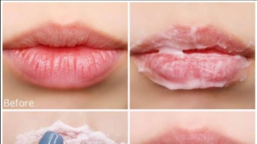 Chị em không lo môi nẻ nhờ áp dụng những cách sau