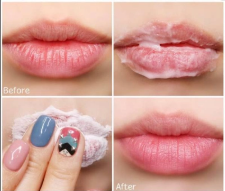 Chị em không lo môi nẻ nhờ áp dụng những cách sau