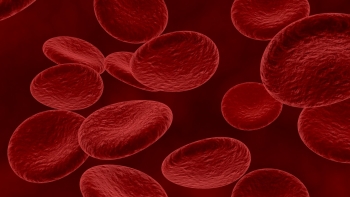 Người thiếu máu do thiếu sắt nên bổ sung thực phẩm gì?