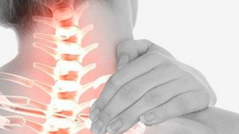 Người trẻ đừng chủ quan với các triệu chứng thoái hoá đốt sống cổ