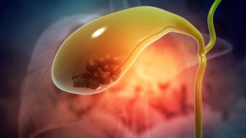 Các bệnh lý thường gặp về túi mật