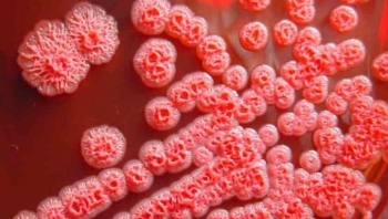 Khuẩn "ăn thịt người" Whitmore khiến 9 người tử vong