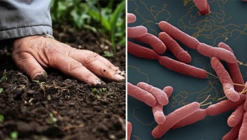 Bỏ túi bộ tips phòng bệnh "ăn thịt người" Whitmore