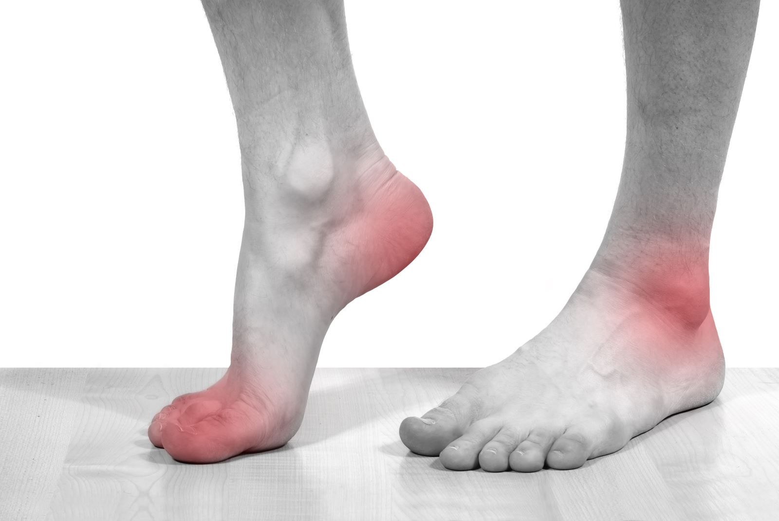 Những "bí kíp" chữa gout bằng thảo dược dân gian cực dễ thực hiện