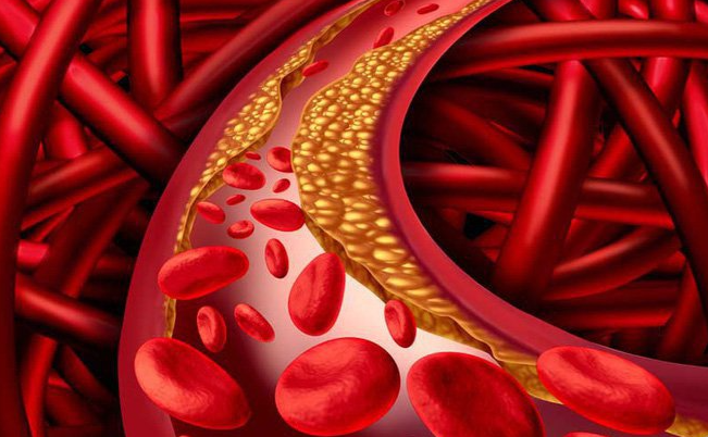 Chất béo không bão hòa đa có thể giúp giảm mức cholesterol