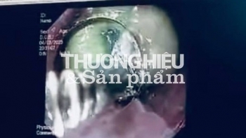 Nghệ An: Một sản phụ suýt mất mạng vì nuốt túi mật lợn