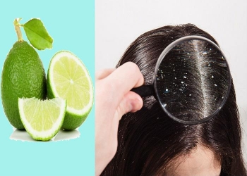 Nước cốt chanh - "Thần dược" được nhiều người lựa chọn để loại bỏ gầu