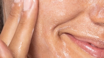 10 bí quyết giảm nhờn, giảm dầu cho da hiệu quả vào mùa hè