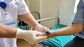 Xuất hiện các ca nghi mắc bệnh Than tại Lai Châu