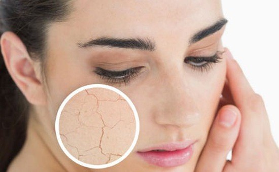 Da khô và bị tổn thương do thiếu vitamin Da khô và bị tổn thương do thiếu vitamin