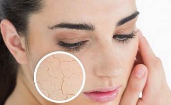 Những dấu hiệu cho thấy cơ thể bạn đang thiếu Vitamin C