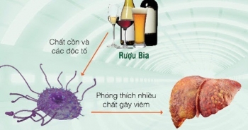 Những cây thuốc nam giúp cải thiện thức năng gan, mát gan, giải độc gan do uống nhiều bia rượu