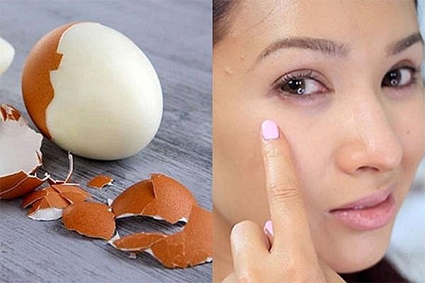 Mách bạn cách trị quầng thâm mắt tại nhà đơn giản, hiệu quả