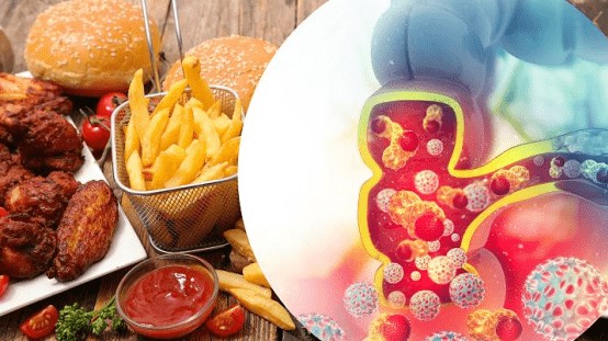 Các loại thực phẩm phổ biến đang tàn phá sức khỏe đường ruột của bạn