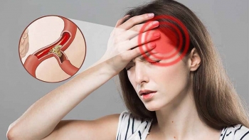 Ăn gì để cải thiện tình trạng thiếu máu não?