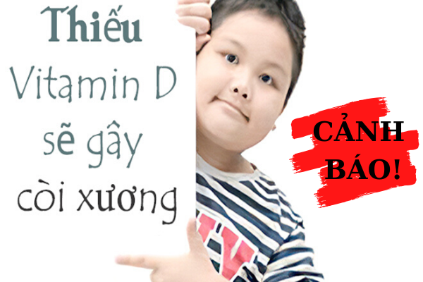 Nguyên nhân bệnh còi xương ở trẻ em và cách khắc phục