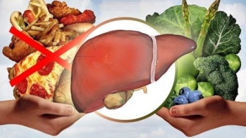 Người bệnh viêm gan B mạn tính nên ăn uống thế nào để phòng ngừa biến chứng?