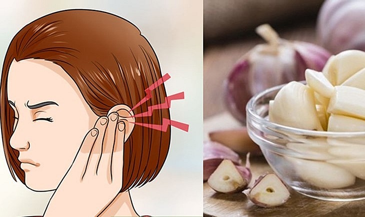 7 lợi ích của dầu tỏi với sức khỏe 7 lợi ích của dầu tỏi với sức khỏe