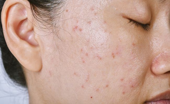 Dầu tẩy trang với cơ chế dầu hòa tan dầu sẽ lấy sạch bụi bẩn và mỹ phẩm từ sâu lỗ chân lông Dầu tẩy trang với cơ chế dầu hòa tan dầu sẽ lấy sạch bụi bẩn và mỹ phẩm từ sâu lỗ chân lông