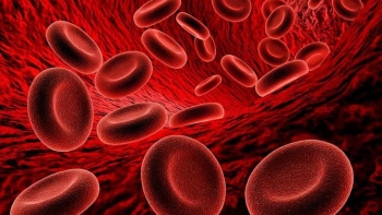 Người bệnh thiếu máu cần bổ sung ba nhóm thực phẩm này