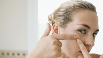 Những sai lầm phổ biến khi chăm da dầu mụn