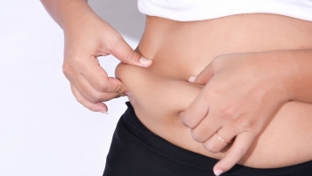 Cảnh báo bạn các loại thực phẩm và đồ uống phổ biến gây tích mỡ ở bụng