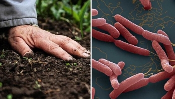 Bộ Y tế đưa ra khuyến cáo phòng chống bệnh Whitmore