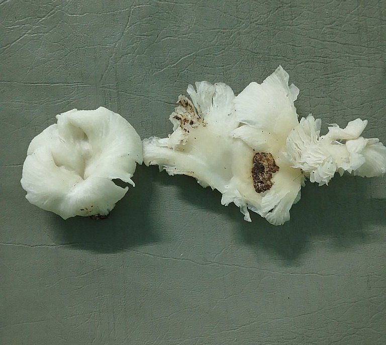 Nấm lạ khiến 3 người trong một gia đình 