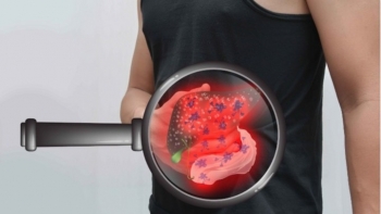 Điểm mặt những thức ăn là "kẻ thù thầm lặng" của gan