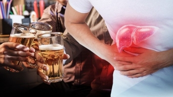 Uống bia ảnh hưởng như thế nào đến sức khoẻ?