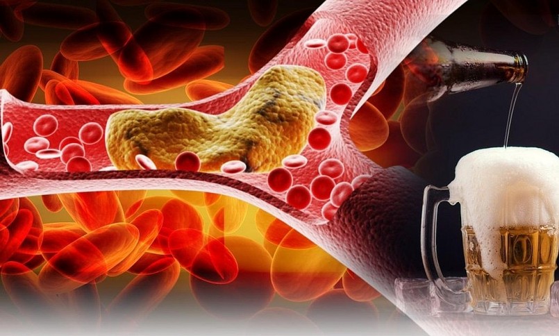 Uống bia ảnh hưởng như thế nào đến sức khoẻ?