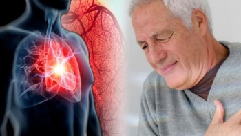 Người bệnh tim mạch nên kiêng ăn những thực phẩm này?