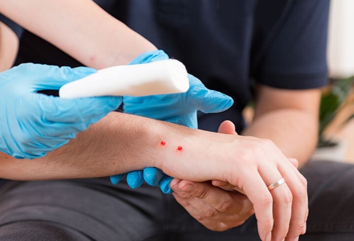 Cần đề phòng rắn lục đuôi đỏ cắn trong thời tiết mưa nhiều