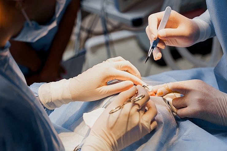 Phẫu thuật hút mỡ và các biến chứng nguy hiểm tính mạng có thể gặp